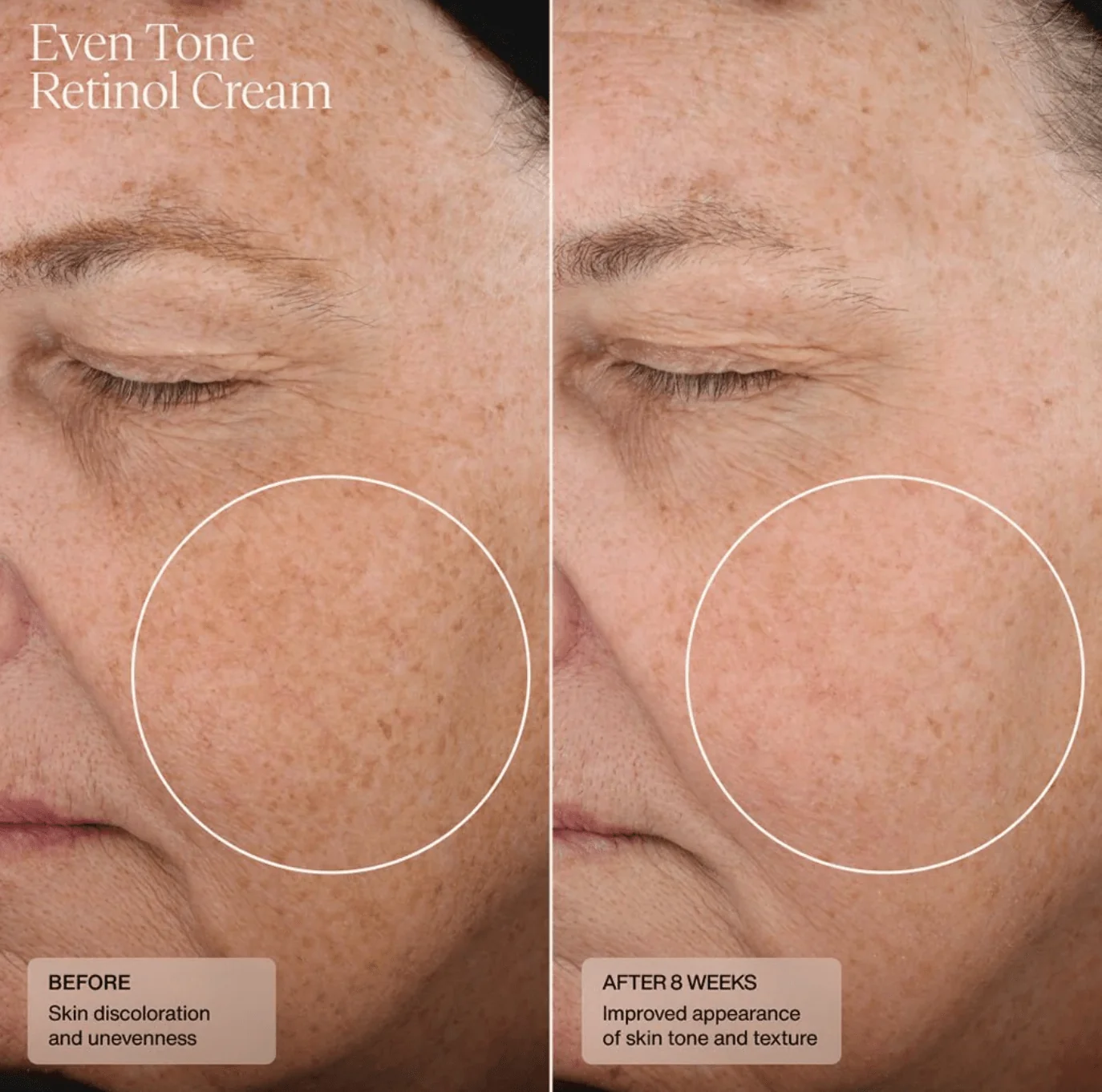 Senté Even Tone Retinol Cream - Image 3