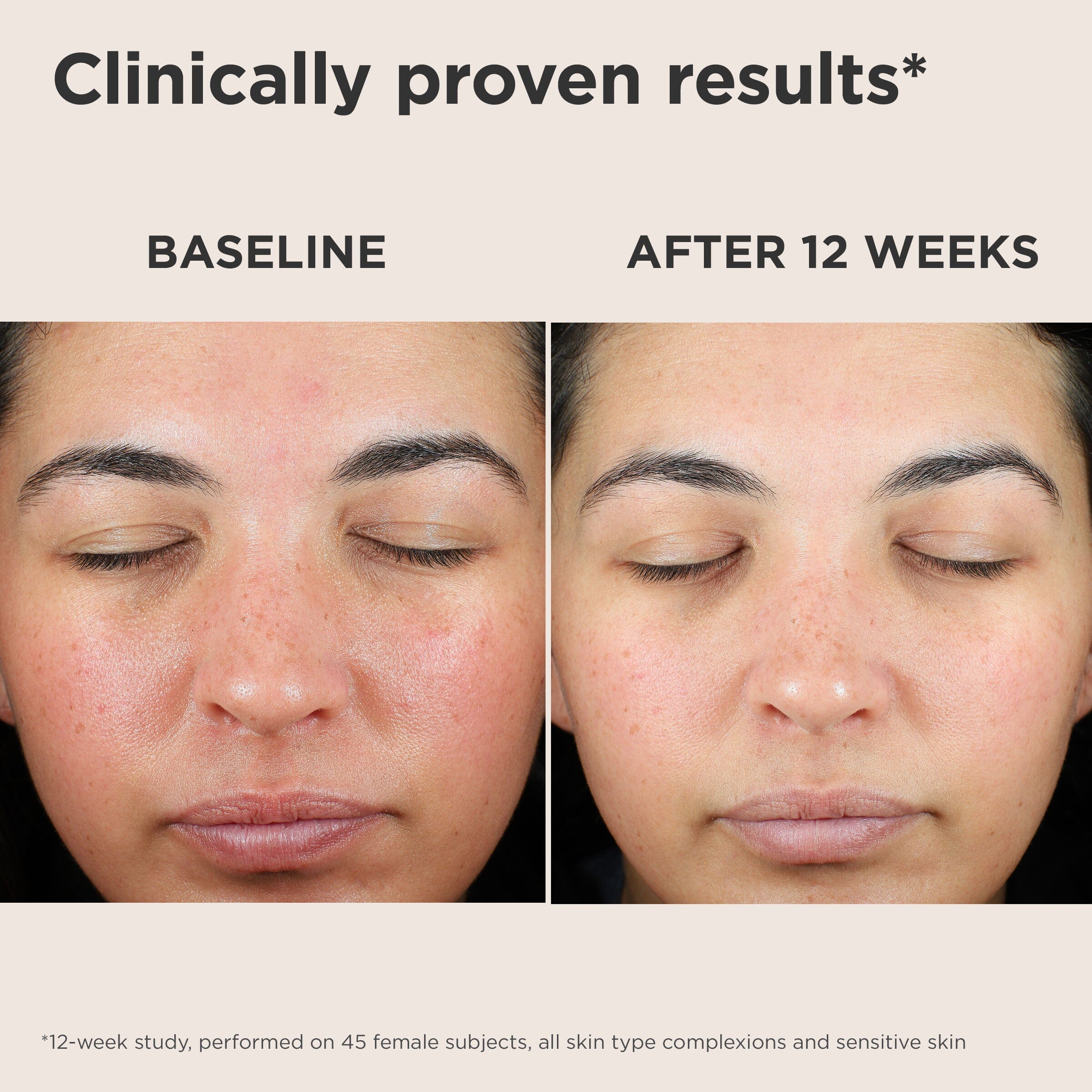 EltaMD UV Skin Recovery Green Tint SPF 50 - Image 5