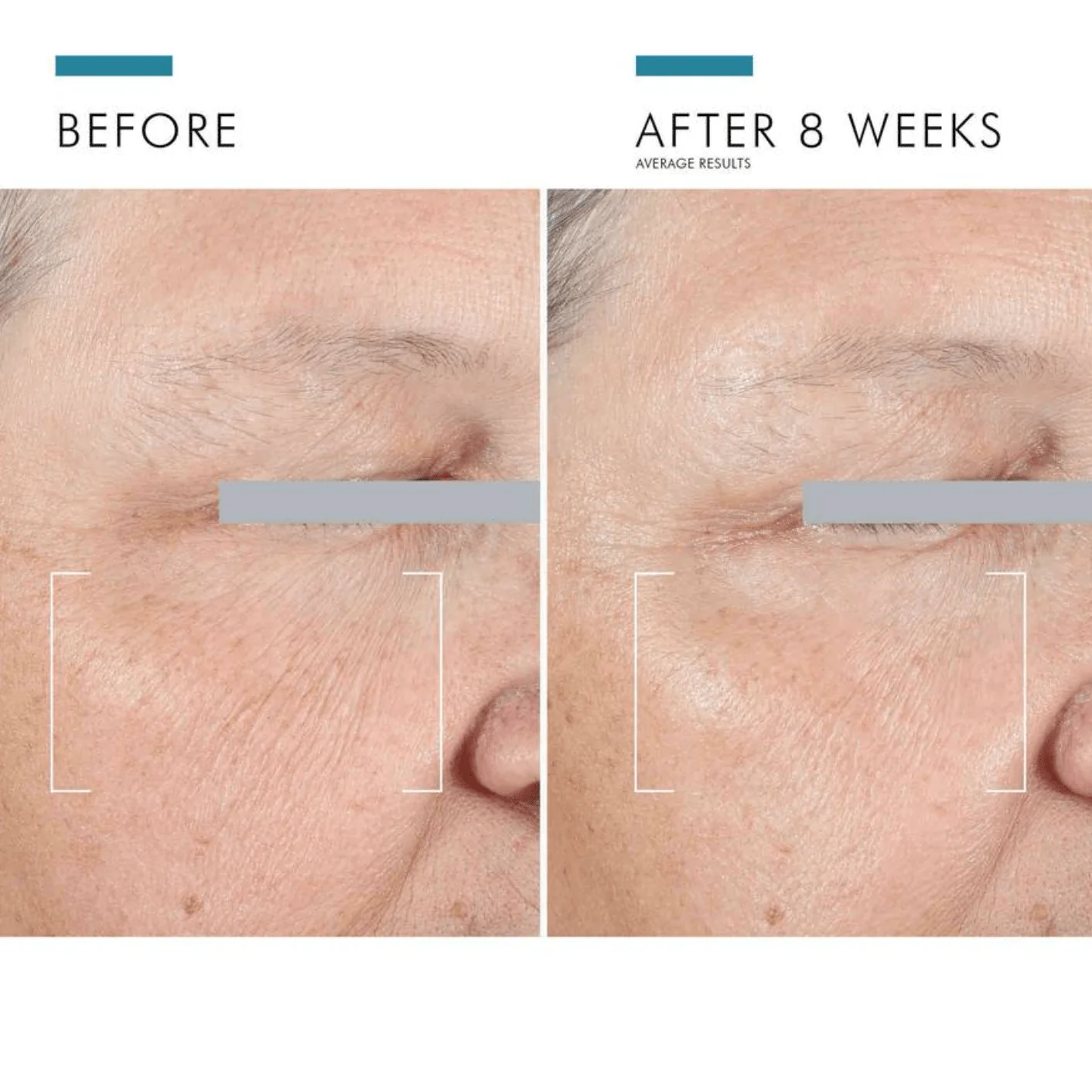SkinCeuticals A.G.E. Advanced Eye - Image 3